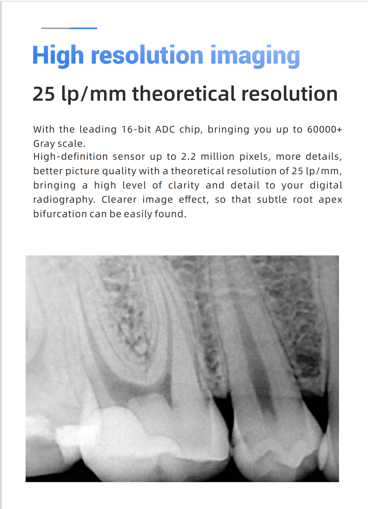 Woodpecker® i-Sensor Digital X-Ray Sensor--Buy 2 get 1 for FREE, valid till Dec 31st, 2025